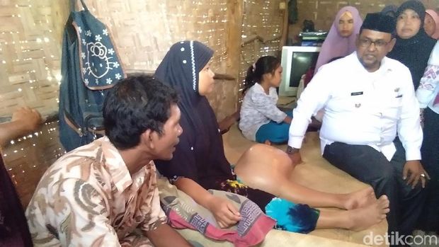 Derita Suhati, Penderita Kanker Tulang di Rumah Gubuk Aceh Utara