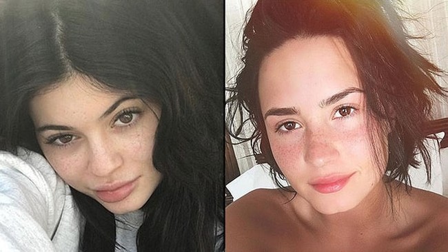 Freckles atau bercak di wajah biasanya ditutupi untuk tampilan flawless yang sempurna. Namun enam selebriti ini membuktikan bila mereka tetap cantik walau memiliki freckless di wajah. Foto: Dok. Instagram