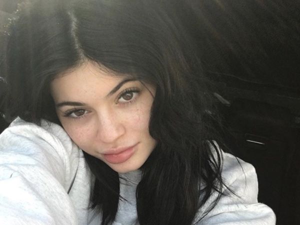 Foto: Saat Selebriti Pamer Freckless di Wajah, Tetap Cantik!