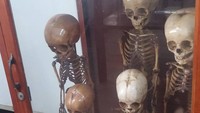 Kamu akan menemukan tengkorak manusia dan berbagai bagian tubuh di gelas kaca (wiesnerfilms/Instagram)