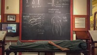 Di Museum Ellis Pathological Museum, traveler dapat melihat display yang menunjukkan penyakit jantung, kanker, dan metode perawatan serta pencegahannya (christophertoms/Instagram)