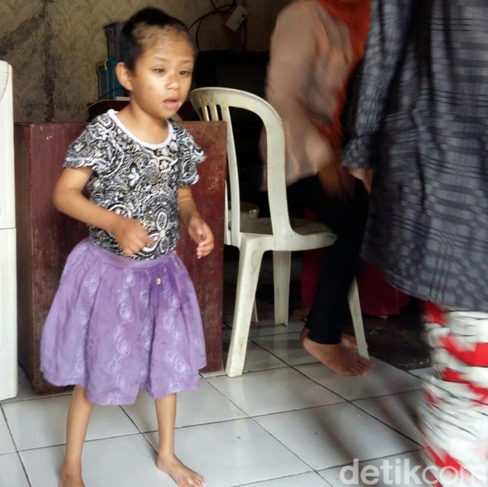 Kondisi Bunga, Bocah Sukabumi yang Diikat Ortu Mulai Membaik