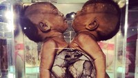 Seiring dengan perkembangannya, kini terdapat enam museum medis kecil di dalam Museum Siriraj di Bangkok. Museumnya antara lain, Ellis Pathological Museum, Congdon Anatomical Museum, Sood Sangvichien Prehistoric Museum and Laboratory, Parasitology Museum, Songkran Niyomsane Forensic Medicine Museum, dan yang terbaru Siriraj Bimuksthan Museum (aforantoaneta/Instagram)