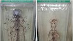 Foto: Jangan Lihat Kalau Takut, Museum Kematian di Bangkok