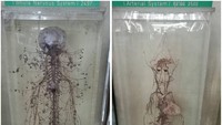 Tak hanya potongan tubuh, sistem tubuh manusia berupa pembuluh darah pun ditampilkan di dalam museum (emmaliin1/Instagram)