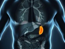 Limpa Raksasa Berbobot 8,5 Kg Diangkat dari Tubuh Pria India