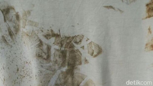 Pakaian dengan Jejak Sepatu Aparat Jadi Barbuk Kekeraan Pada Wartawan