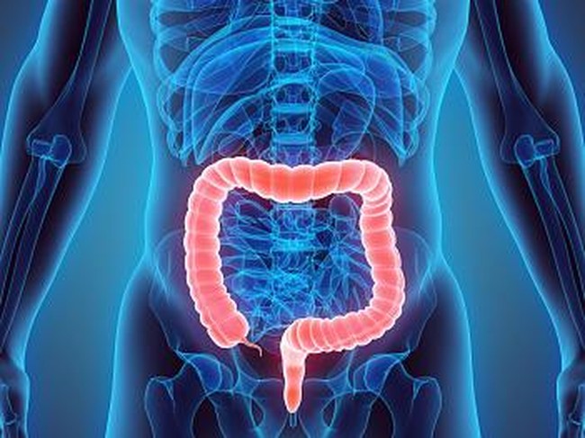 Waspada! 4 Hal Ini Bisa Jadi Petunjuk Kanker Usus Besar