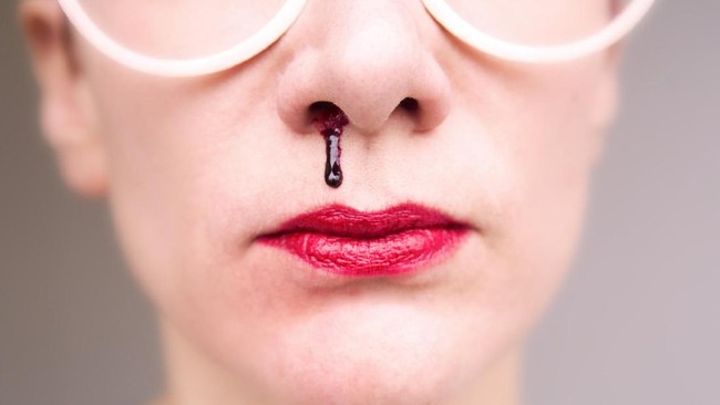 Harus Tahu, 5 Gejala dari Kanker Nasofaring