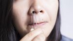 10 Hal Tak Terduga yang Bisa Memicu Mimisan