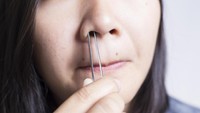 Sebagian orang mungkin gemas ingin selalu mencabut bulu yang keluar dari hidung. Nah hati-hati melakukannya karena bisa jadi melukai pembuluh darah dan memicu mimisan. (Foto: Thinkstock)