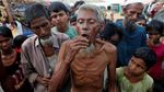 Anak Pengungsi Rohingya Dapat Vaksinasi Kolera