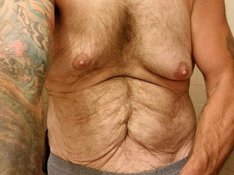 Potret Mereka yang Berhasil Kuruskan Badan Hingga Kulitnya Bergelambir