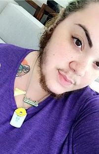 Wajah Dipenuhi Janggut, Wanita Ini Percaya Diri Berkat Dukungan Pacar