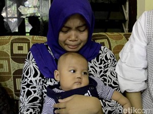 Sekat Hidung Bayi di Pekalongan Hilang, RSUD: Itu Resiko Medis