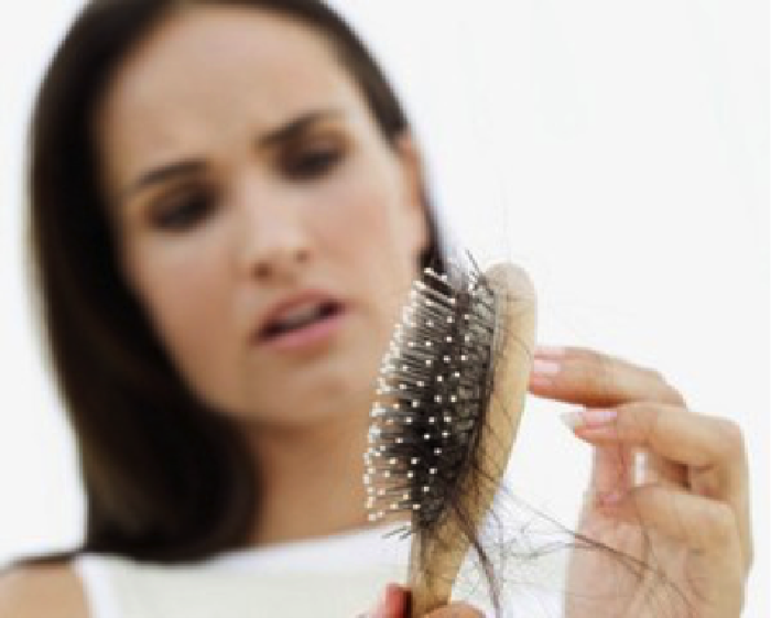 Svenson Sukses Beri Solusi Masalah Rambut Rontok Selama 21 Tahun
