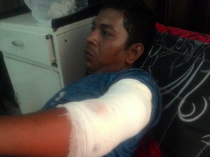 Tak Bawa Senter Saat Cari Ikan, Guru Honorer di Aceh Diterkam Buaya
