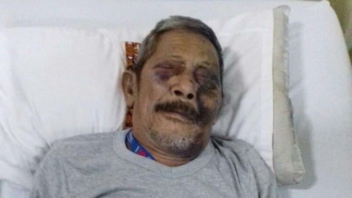 Viral Foto Kakek Hasan Korban Tabrakan, Begini Kisah Sebenarnya