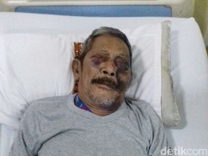 Viral Foto Kakek Hasan Korban Tabrakan, Begini Kisah Sebenarnya