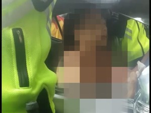 Viral Wanita Buka Baju Setelah Menabrak, Dokter: Itu Reaksi Stres