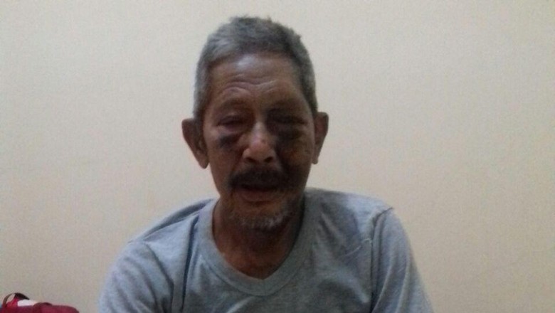 Kondisi Membaik, Kakek Hasan yang Kisahnya Viral Pulang dari RS Polri Kondisi Membaik, Kakek Hasan yang Kisahnya Viral Pulang dari RS Polri