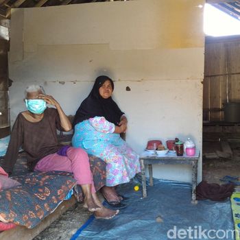 Wajahnya Digerogoti Kanker, Mbah Jiyem Sering Menangis Kesakitan