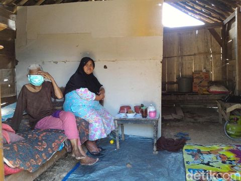 Wajah Nenek Sebatang Kara di Boyolali Ini Digerogoti Kanker Ganas