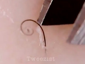 Ngilu! Selebgram Ini Beken Berkat Hobi Mencabuti Bulu Kaki