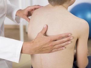 Kata Dokter Soal Penyebab Skoliosis, Generasi Milenial Rentan Lho
