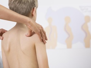 Pundak Tinggi Sebelah Gejala Umum Skoliosis
