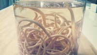 Cacing parasit yang mirip mi ini khususnya dari spesies Ascaris lumbricoides atau cacing gelang. Bentuknya panjang dan bulat seperti gelang. (Foto: Instagram/david_ruizh)  