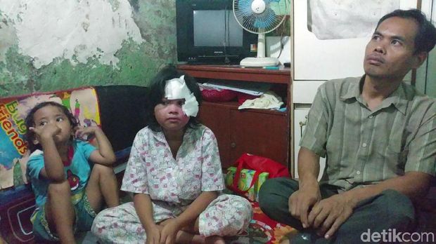 Ridwan Kamil Beri Kejutan Ultah Pada Rachel Korban Minyak Panas