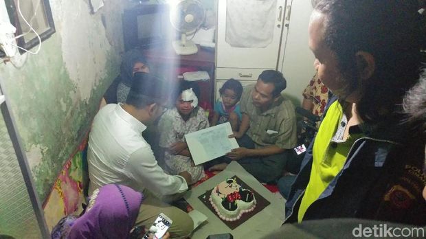 Ridwan Kamil Beri Kejutan Ultah Pada Rachel Korban Minyak Panas