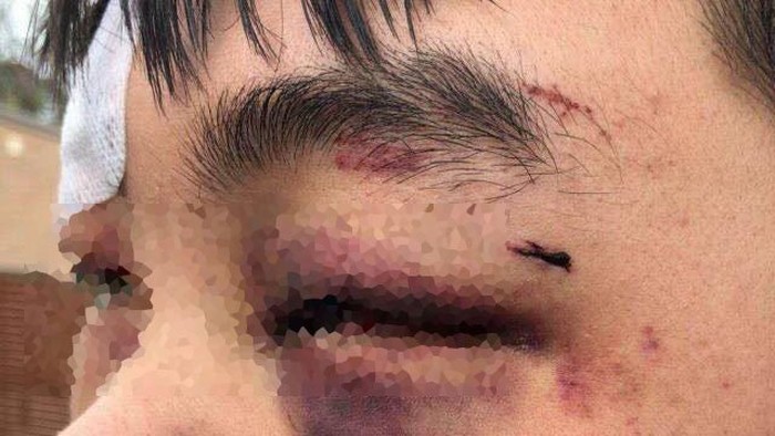 Siswa Asal China Dipukul di Canberra