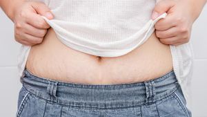 Ini Dia Orang-orang yang Berisiko Memiliki Stretch Mark