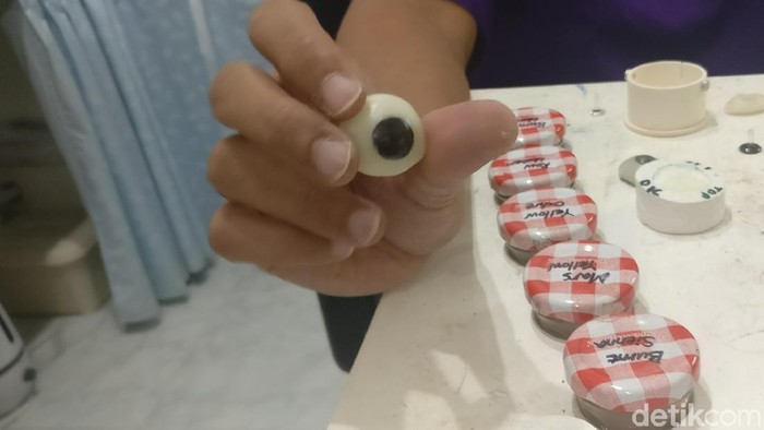 Kisah Pembuat Mata Palsu untuk Pengidap Retinoblastoma