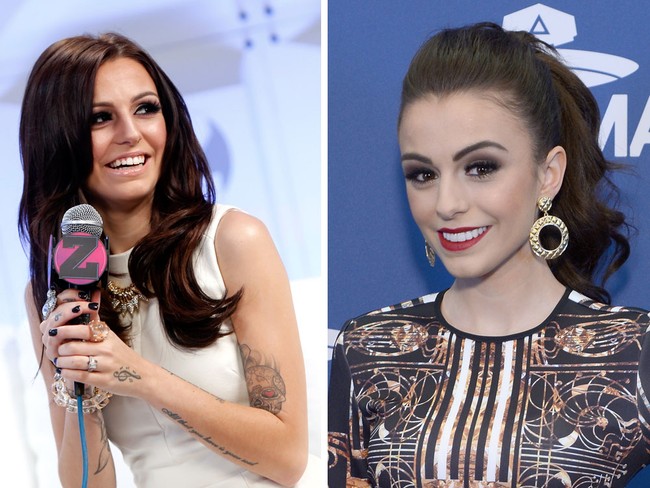 Penyanyi jebolan X Factor Cher Lloyd dulunya punya gigi yang renggang dan tidak rata. Setelah gigi diperbaiki, senyumnya jadi lebih manis. Foto: Getty Images