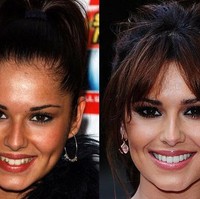 Gigi gingsul Cheryl sebenarnya sudah cukup manis. Tapi setelah dibuat lebih rata, ia jadi tampak lebih percaya diri tersenyum. Foto: Getty Images