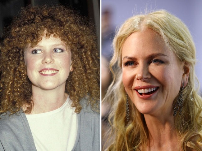 Nicole Kidman memiliki gigi yang terlalu masuk sehingga gusinya tampak menonjol. Tampaknya aktris 50 tahun itu memasang implan agar bentuk giginya lebih proporsional. Foto: Getty Images