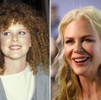 Nicole Kidman memiliki gigi yang terlalu masuk sehingga gusinya tampak menonjol. Tampaknya aktris 50 tahun itu memasang implan agar bentuk giginya lebih proporsional. Foto: Getty Images