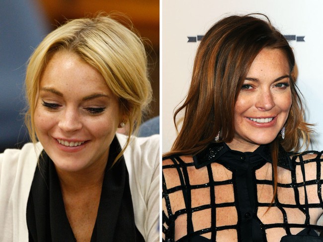 Gigi Lindsay Lohan sempat rusak akibat konsumsi alkohol dan obat-obatan berlebihan. Setelah kembali ke jalur nya, ia pun memperbaiki giginya.  Foto: Getty Images