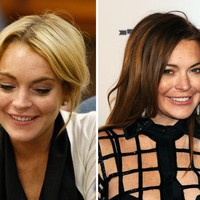 Gigi Lindsay Lohan sempat rusak akibat konsumsi alkohol dan obat-obatan berlebihan. Setelah kembali ke jalur nya, ia pun memperbaiki giginya.  Foto: Getty Images