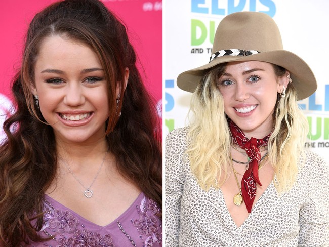 Perubahan yang cukup drastis terjadi pada gigi Miley Cyrus. Saat awal-awal muncul, gigi Miley tak rata dan bergingsul. Berkat veeneer, giginya jadi rapi sempurna. Foto: Getty Images