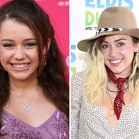 Perubahan yang cukup drastis terjadi pada gigi Miley Cyrus. Saat awal-awal muncul, gigi Miley tak rata dan bergingsul. Berkat veeneer, giginya jadi rapi sempurna. Foto: Getty Images