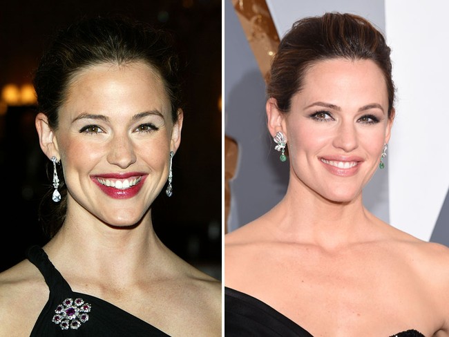 Jennifer Garner pun memiliki gusi yang tampak menonjol ketika tersenyum. Pemasangan veeneer membuat senyumnya lebih cantik. Foto: Getty Images