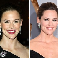 Jennifer Garner pun memiliki gusi yang tampak menonjol ketika tersenyum. Pemasangan veeneer membuat senyumnya lebih cantik. Foto: Getty Images