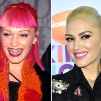 Gwen Stefani dulunya memakai kawat gigi untuk menyempurnakan penampilannya. Tak sia-sia, kini senyumnya lebih menarik. Foto: Getty Images