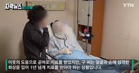 Tragis, Jelang Nikah Wanita Ini Malah Disiram Kuah Ramen Panas oleh Temannya