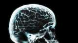 Riset: Pandemi Buat Otak Remaja Alami Penuaan Dini