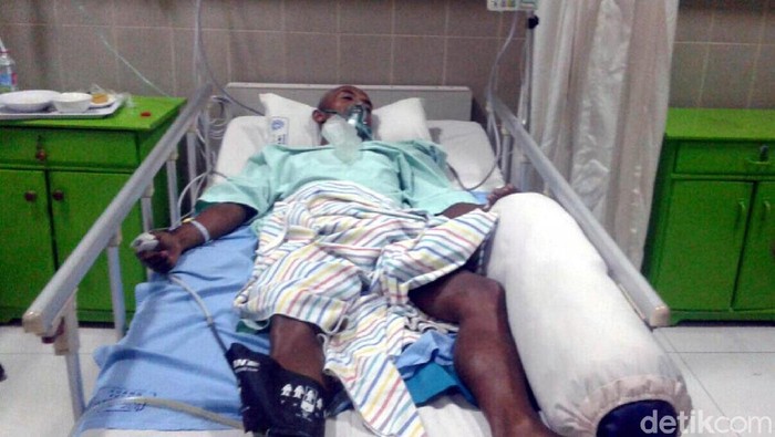 Tersambar Petir, Warga Kebumen Nyaris Tewas